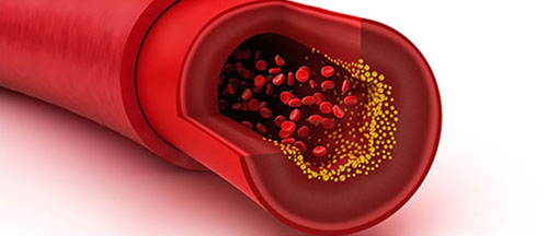 Cholesterol Immunization